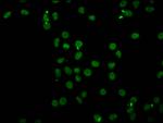 H4K91ac Polyclonal Antibody