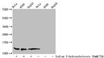 beta-hydroxybutyryl-Histone H4 (Lys91) Antibody in Western Blot (WB)