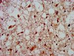 HOXA4 Polyclonal Antibody