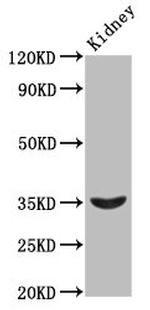 HOXA4 Antibody in Western Blot (WB)