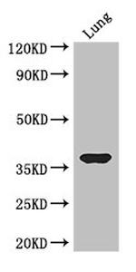 HOXD9 Antibody in Western Blot (WB)