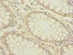 HTR3B Antibody in Immunohistochemistry (Paraffin) (IHC (P))