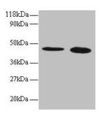 TTC1 Polyclonal Antibody