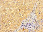 INVS Antibody in Immunohistochemistry (Paraffin) (IHC (P))