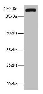 INVS Antibody in Western Blot (WB)