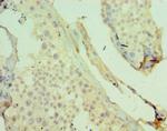 JMJD2B Polyclonal Antibody