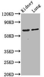 SRRM4 Antibody in Western Blot (WB)