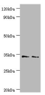KIR2DS4 Antibody in Western Blot (WB)