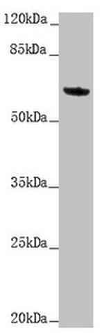 Cytokeratin 6A Antibody in Western Blot (WB)