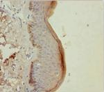 Cytokeratin 6A Polyclonal Antibody