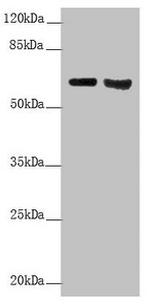 Cytokeratin 6A Antibody in Western Blot (WB)