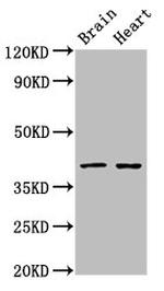 Lass1 Antibody in Western Blot (WB)