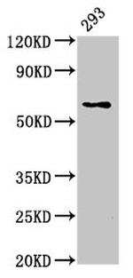 LPCAT2 Antibody in Western Blot (WB)