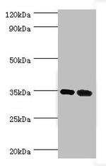 MAGEA6 Antibody in Western Blot (WB)