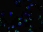 MAK Polyclonal Antibody