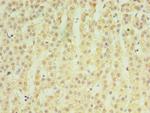 MATN3 Polyclonal Antibody