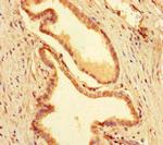 MEIS1 Polyclonal Antibody