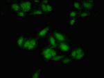 MEIS2 Polyclonal Antibody