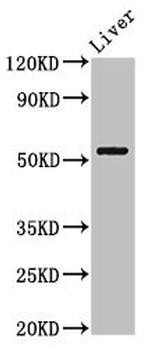 MEIS2 Antibody in Western Blot (WB)