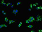 MFI2 Polyclonal Antibody
