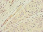 MGAT1 Polyclonal Antibody