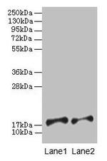 PFDN5 Polyclonal Antibody