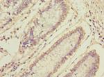 MLF1 Antibody in Immunohistochemistry (Paraffin) (IHC (P))