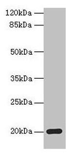 MPV17 Polyclonal Antibody