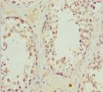 MRAS Polyclonal Antibody