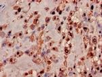 MRPL19 Antibody in Immunohistochemistry (Paraffin) (IHC (P))