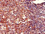 MRPL19 Antibody in Immunohistochemistry (Paraffin) (IHC (P))