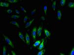 SNRPG Polyclonal Antibody