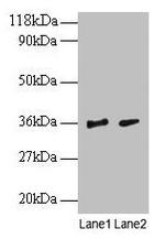 SNRPG Antibody in Western Blot (WB)