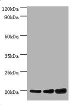 NAA20 Polyclonal Antibody