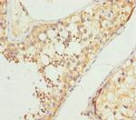 NCALD Polyclonal Antibody