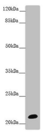 NCALD Antibody in Western Blot (WB)