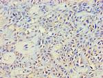 NCK2 Antibody in Immunohistochemistry (Paraffin) (IHC (P))