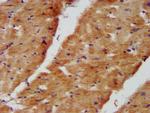 NDUFB8 Antibody in Immunohistochemistry (Paraffin) (IHC (P))