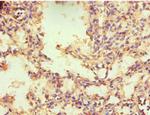TR2 Polyclonal Antibody