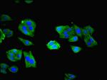 NXF5 Polyclonal Antibody