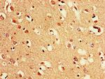 PAK3 Antibody in Immunohistochemistry (Paraffin) (IHC (P))