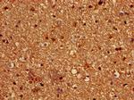PALM Antibody in Immunohistochemistry (Paraffin) (IHC (P))