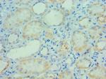 PARP3 Antibody in Immunohistochemistry (Paraffin) (IHC (P))