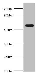 PARP3 Antibody in Western Blot (WB)