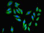 PARP3 Polyclonal Antibody