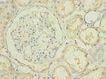 PBLD Polyclonal Antibody