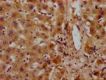 PET112 Antibody in Immunohistochemistry (Paraffin) (IHC (P))