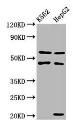 PET112 Antibody in Western Blot (WB)
