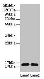 RPL36AL Polyclonal Antibody