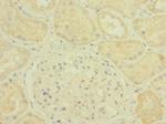 PLXNB2 Polyclonal Antibody